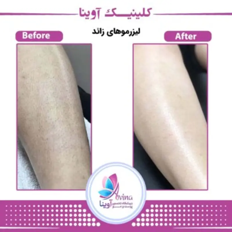 کلینیک زیبایی آوینا کرج