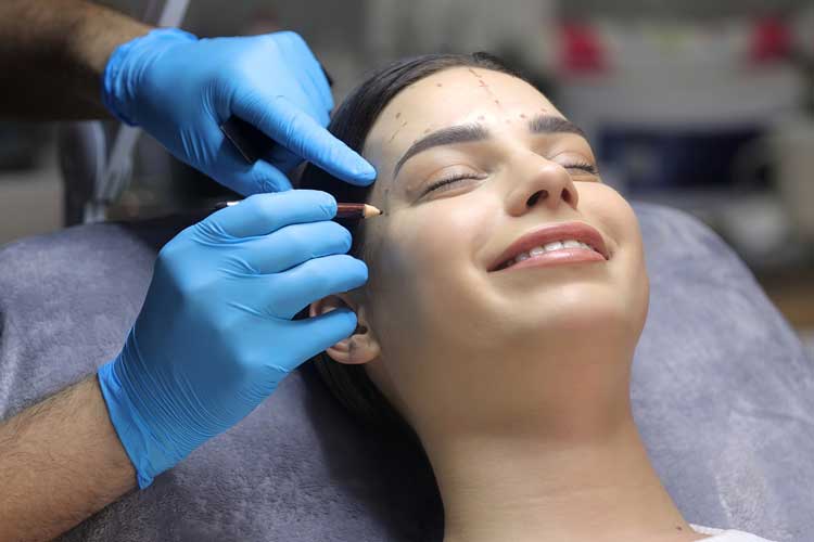 مراحل لیفت شقیقه