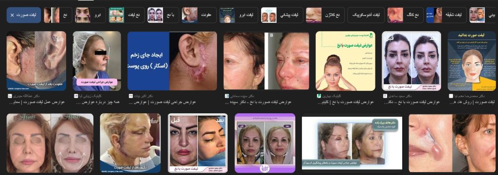 چرا نباید به سالنهای آرایشی برای تزریق یا درمان پوست و مو مراجعه کنیم؟