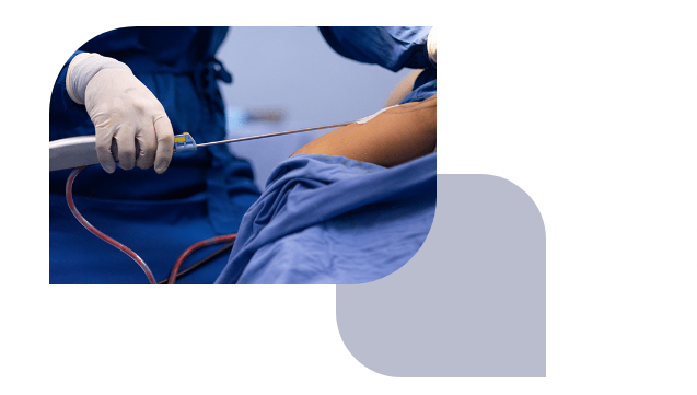 مقایسه سه روش لاغری محبوب دنیا لیپوماتیک، لیپوساکشن، ابدومینوپلاستی