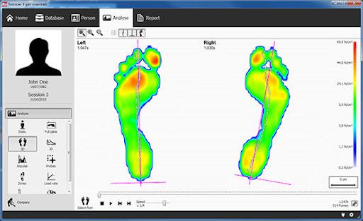 خدمات اسکن کف پا