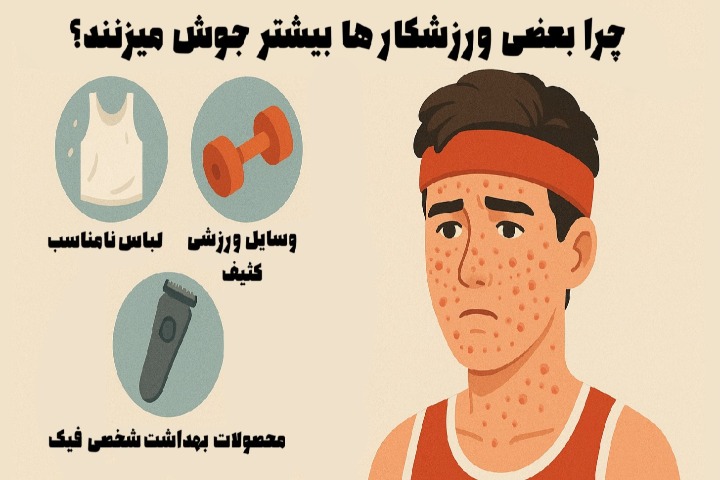 چرا بعضی ورزشکارها بیشتر جوش میزنند؟