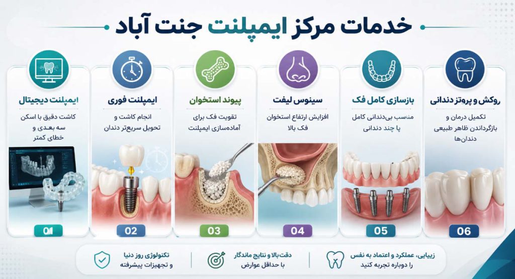 خدمات مرکز ایمپلنت در جنت آباد